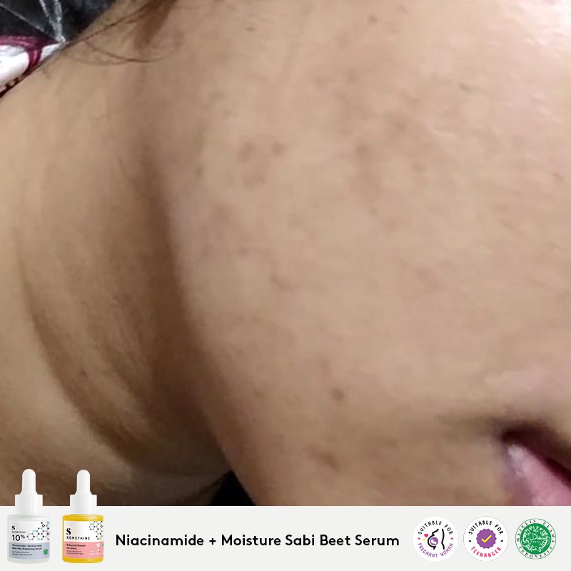 Somethinc 5 Niacinamide Moisture Sabi Beet Serum Somethinc